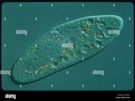  Rhabdostyla: A Single-Celled Whirlwind of Microscopic Majesty!