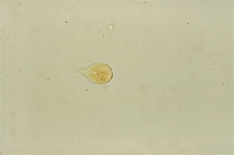  Giardia Lamblia: Một Con Quỷ Nhỏ Cắn Vào Ruột Non Của Bạn và Biến Hình Trong Nước!