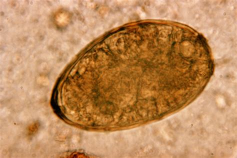  Urogonimus Westermani: A Tiny Fluke with a Big Impact on Your Liver!