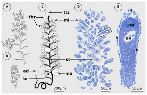  Zoothamnium! A Microscopic Wonder Embarking on Its Journey Across Water Surfaces